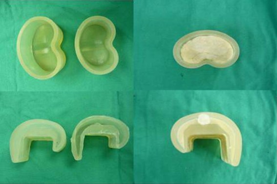 Silicone mold for mobile cement spacer