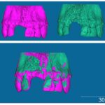 Segmentation and ROI cropping in 3D Slicer for CBCT volume analysis