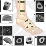 Skeletal sites of interest for bone stress injuries: fibular and tibial diaphysis, distal tibia, base of the 2nd metatarsal, navicular, proximal diaphysis of the 5th metatarsal, and 2nd metatarsal diaphysis. Each panel shows a HR-pQCT slice and a 3D reconstruction of the analyzed slices, highlighting key anatomical features and regions of interest.