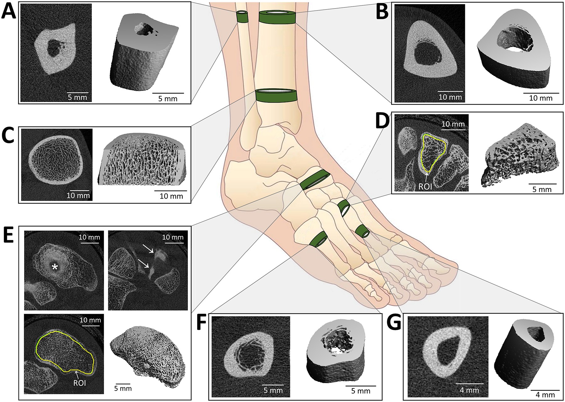 Skeletal sites of interest for bone stress injuries: fibular and tibial diaphysis, distal tibia, base of the 2nd metatarsal, navicular, proximal diaphysis of the 5th metatarsal, and 2nd metatarsal diaphysis. Each panel shows a HR-pQCT slice and a 3D reconstruction of the analyzed slices, highlighting key anatomical features and regions of interest.