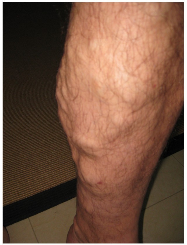 Veins have valves to prevent backflow of blood, particularly in the limbs.