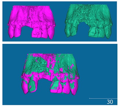 3CEFCEE78CCF4F9B873E24E85600BBAB.jpg showing a 3D Slicer interface with segmentation and registration tools