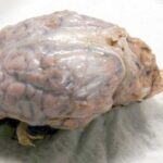 Sheep Brain Dura Mater