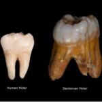 Human Vs Denisovan Molar