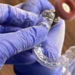 Invisalign clear aligners