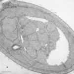 Mammalian lysosomes are too small to accommodate autophagic bodies. Mouse embryonic fibroblasts showing an autophagosome next to (**A**) or fusing with (**B**) an electron dense lysosome. Scale bars: 600 nm (**A**) and 200 nm (**B**).